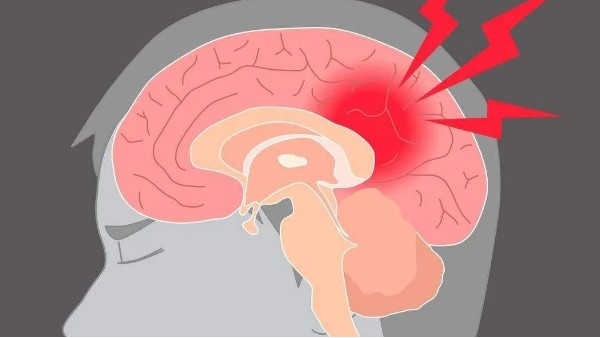 水蛭治療缺血性腦血管病療效肯定、安全簡(jiǎn)便，已被各家公認(rèn)