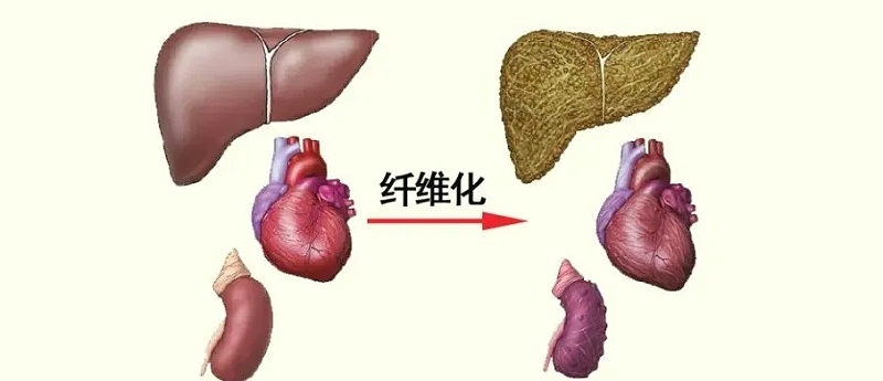 水蛭素、活血化瘀、纖維化