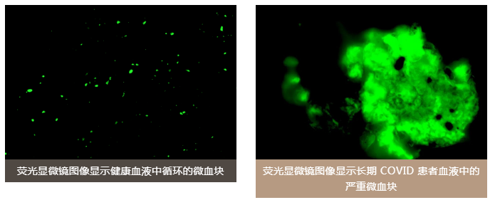 水蛭素、陽(yáng)康、烏梅、壯醫(yī)水蛭療法